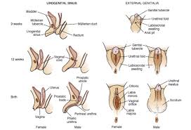 Differences in sex development